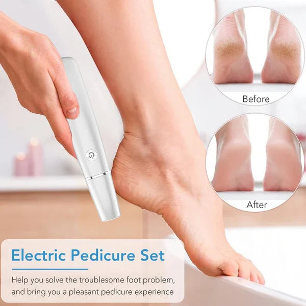 SoleSmooth - Épilateur Électrique de Callosités pour Pieds