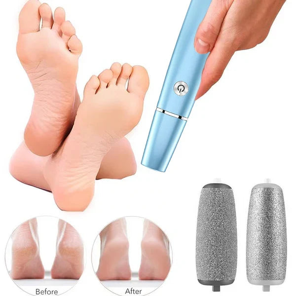 SoleSmooth - Épilateur Électrique de Callosités pour Pieds