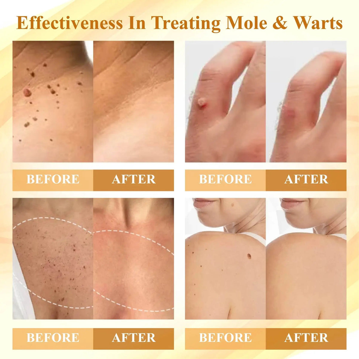 DermaLuxe™ — Faites disparaître les imperfections de la peau et brillez avec une confiance inébranlable