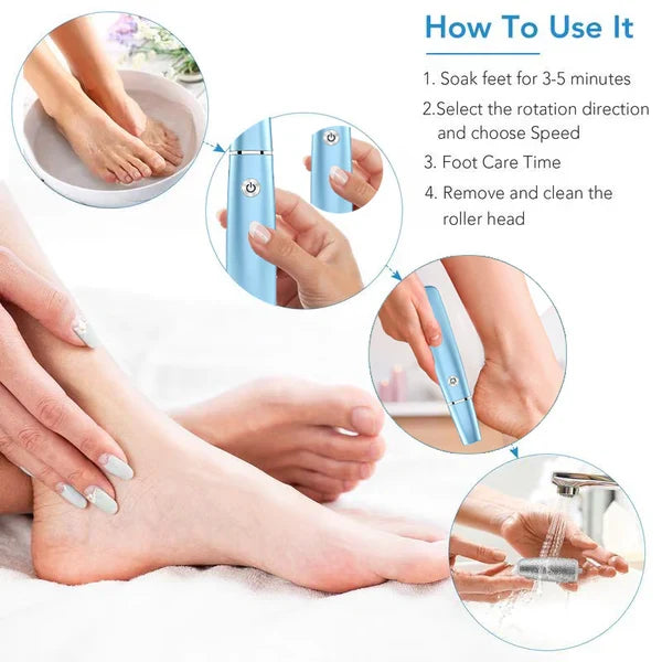 SoleSmooth - Épilateur Électrique de Callosités pour Pieds