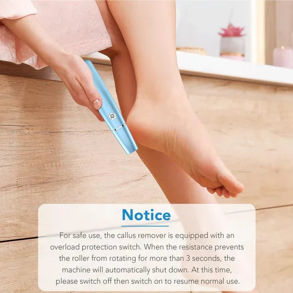 SoleSmooth - Épilateur Électrique de Callosités pour Pieds