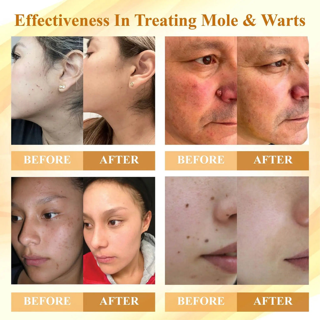 DermaLuxe™ — Faites disparaître les imperfections de la peau et brillez avec une confiance inébranlable