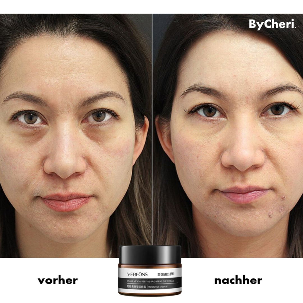 Achetez-en Un, Obtenez-en Un Gratuit | Crème Contour des Yeux Anti-Rides pour Rajeunissement