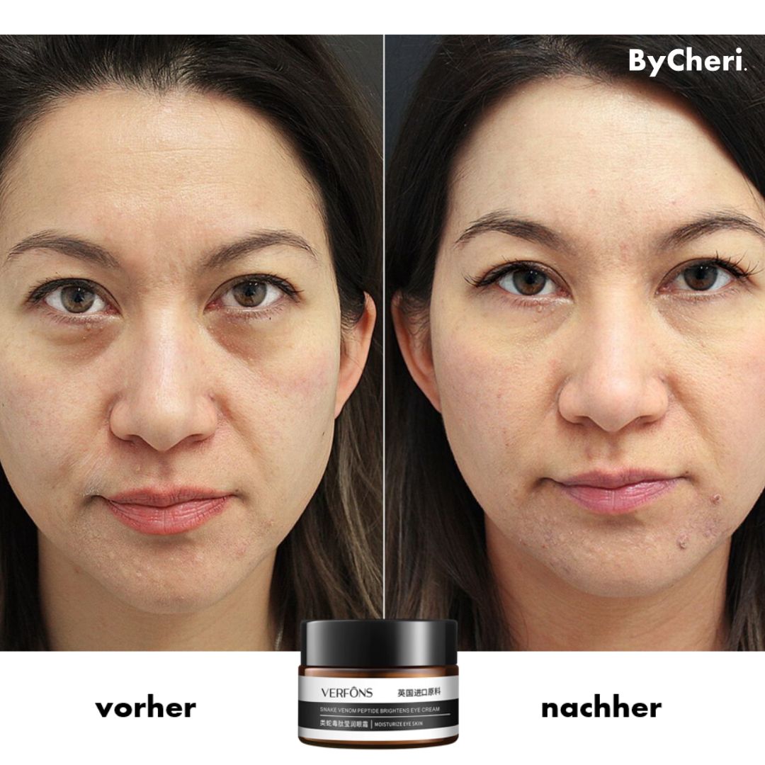 Achetez-en Un, Obtenez-en Un Gratuit | Crème Contour des Yeux Anti-Rides pour Rajeunissement