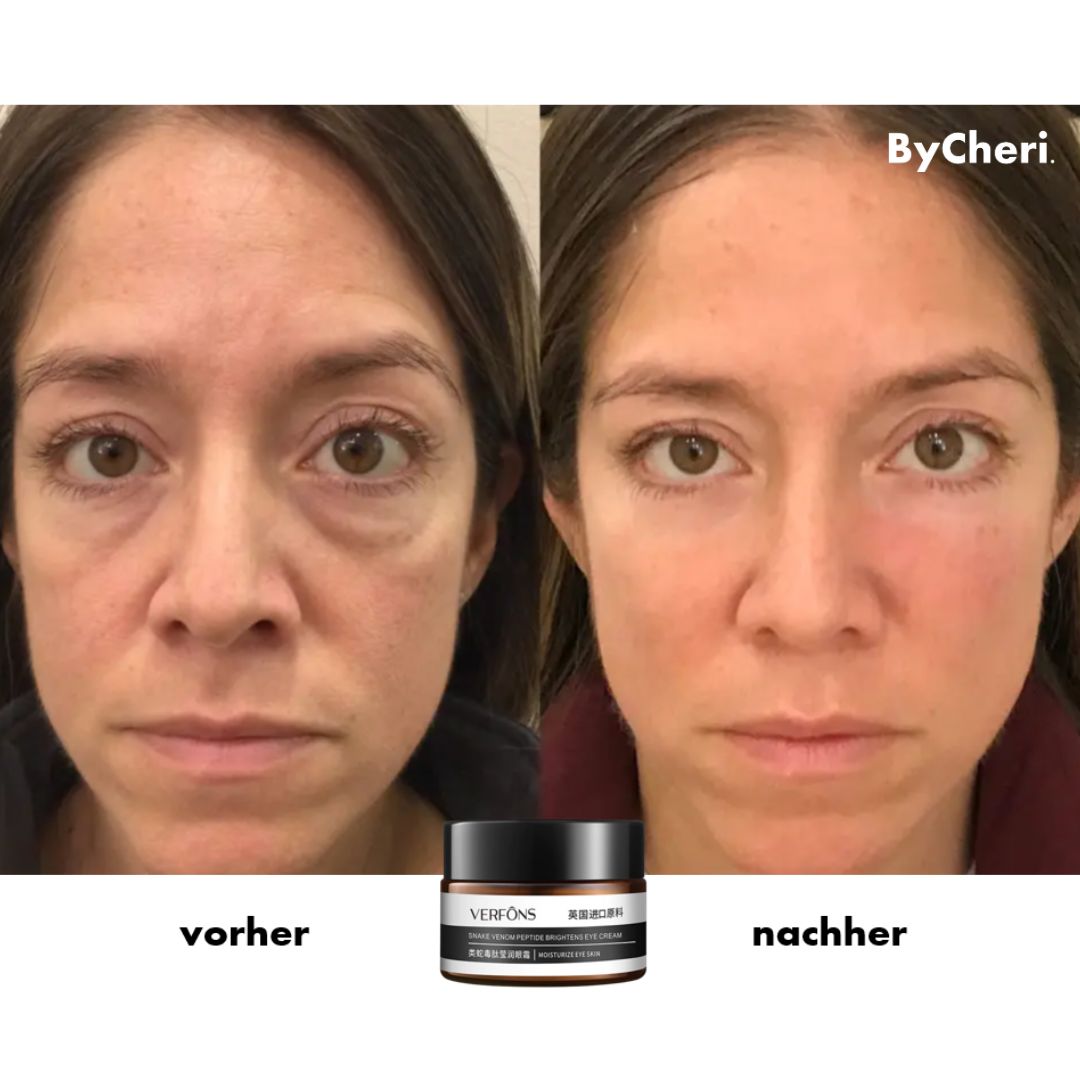 Achetez-en Un, Obtenez-en Un Gratuit | Crème Contour des Yeux Anti-Rides pour Rajeunissement