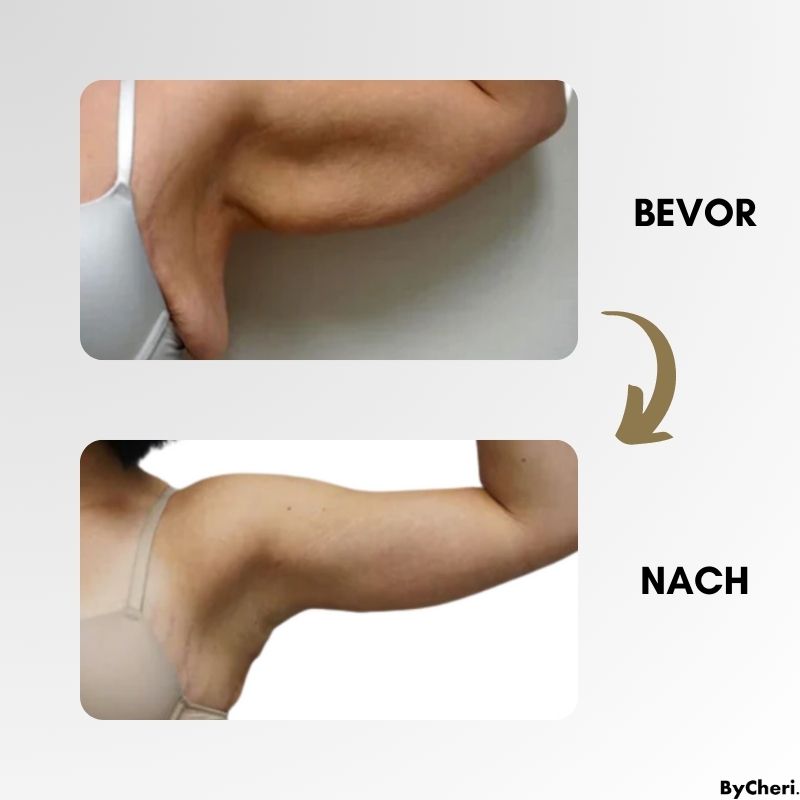 DERNIER JOUR 50% DE RÉDUCTION | LymphMag™ | Se sentir différent en quelques semaines