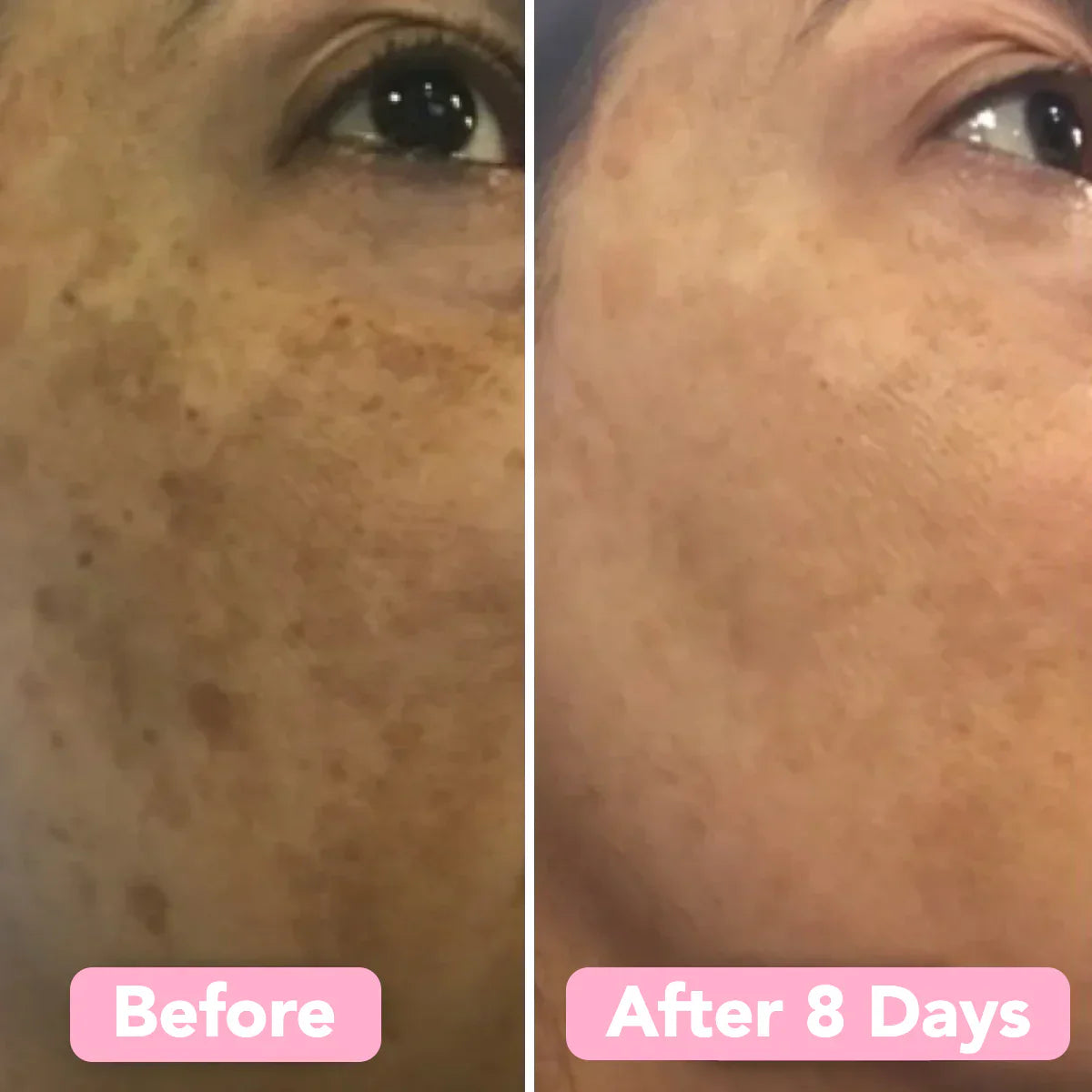CleanPro™ — Révélez votre éclat radieux en estompant rapidement les taches sombres