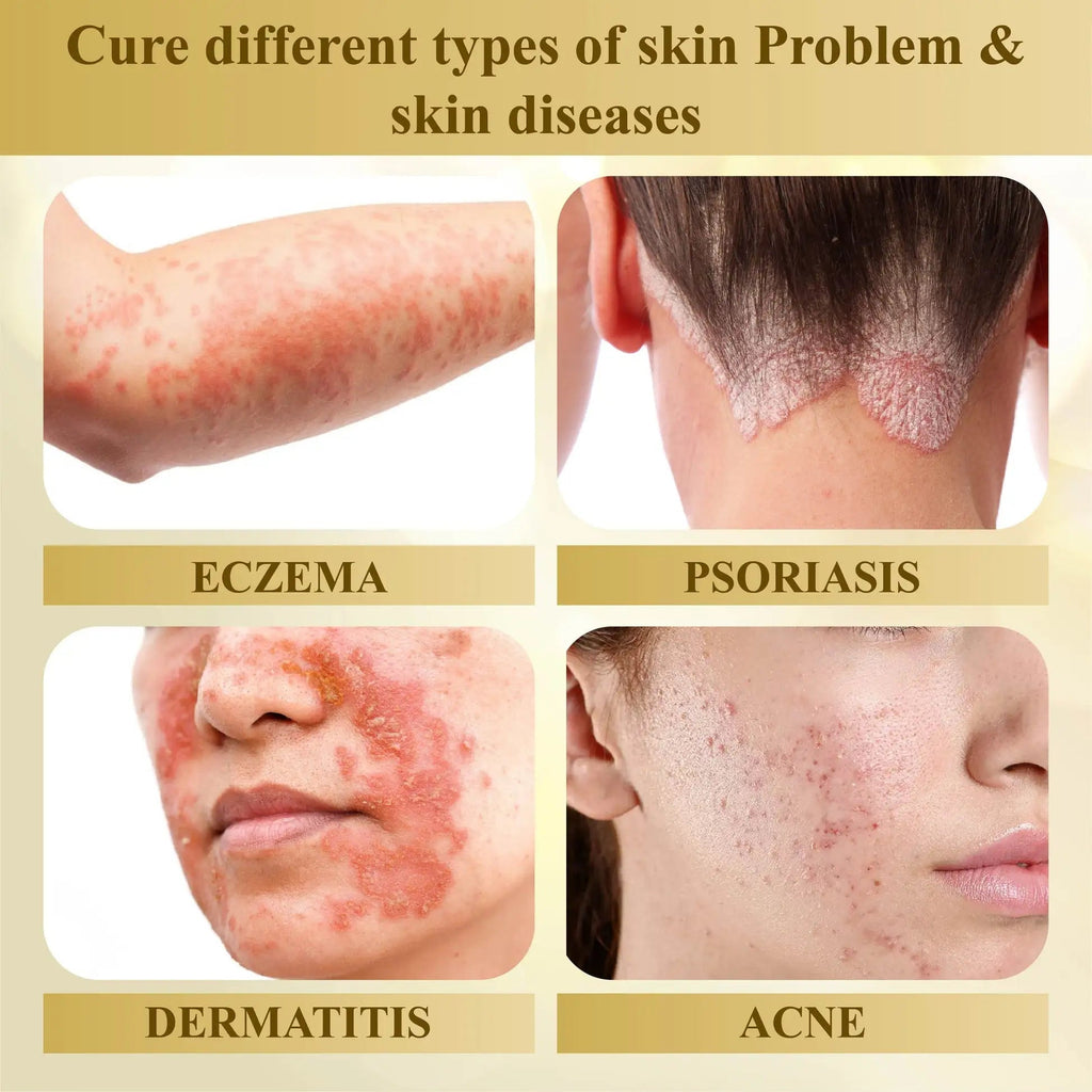DermaLuxe™ — Faites disparaître les imperfections de la peau et brillez avec une confiance inébranlable