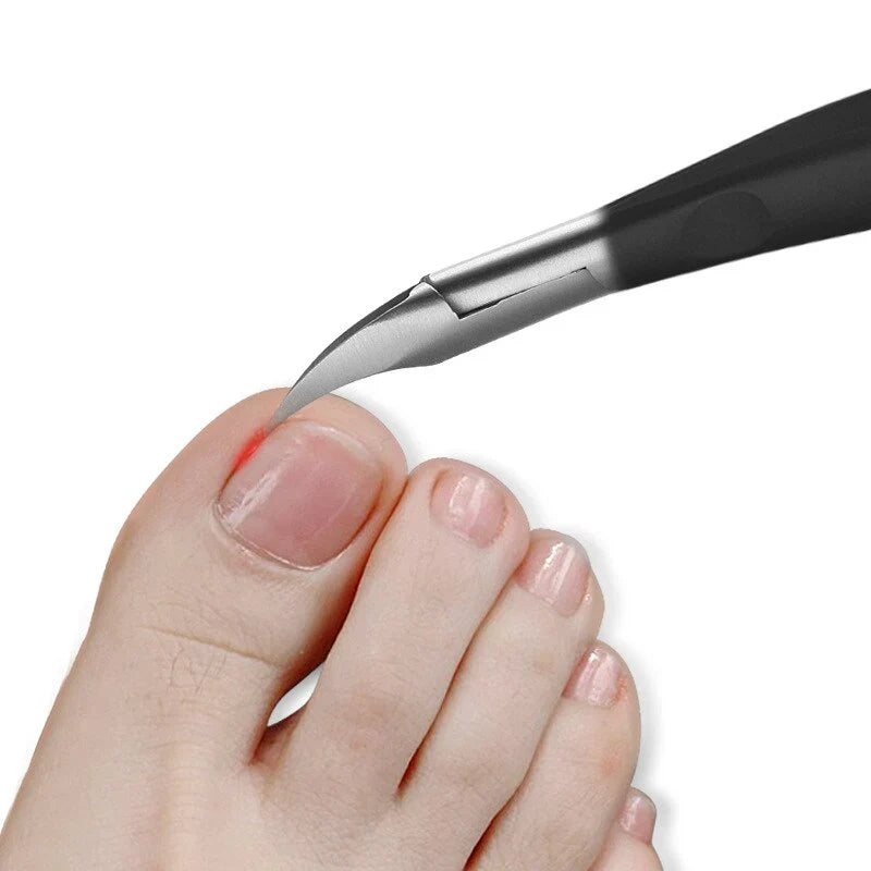 Ciseaux à ongles - Soin professionnel pour ongles incarnés - Trimvex