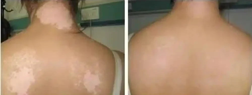 DermaGlow™ — Nourrir la Peau Sèche et Révéler un Teint Plus Sain et Plus Radieux