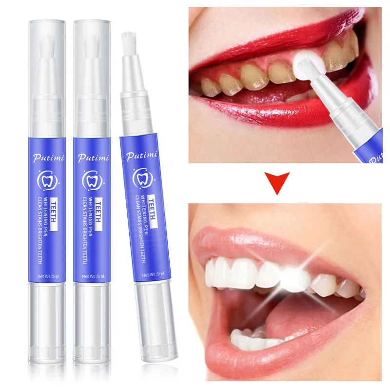 Stylo de Blanchiment Dentaire Correction de Couleur