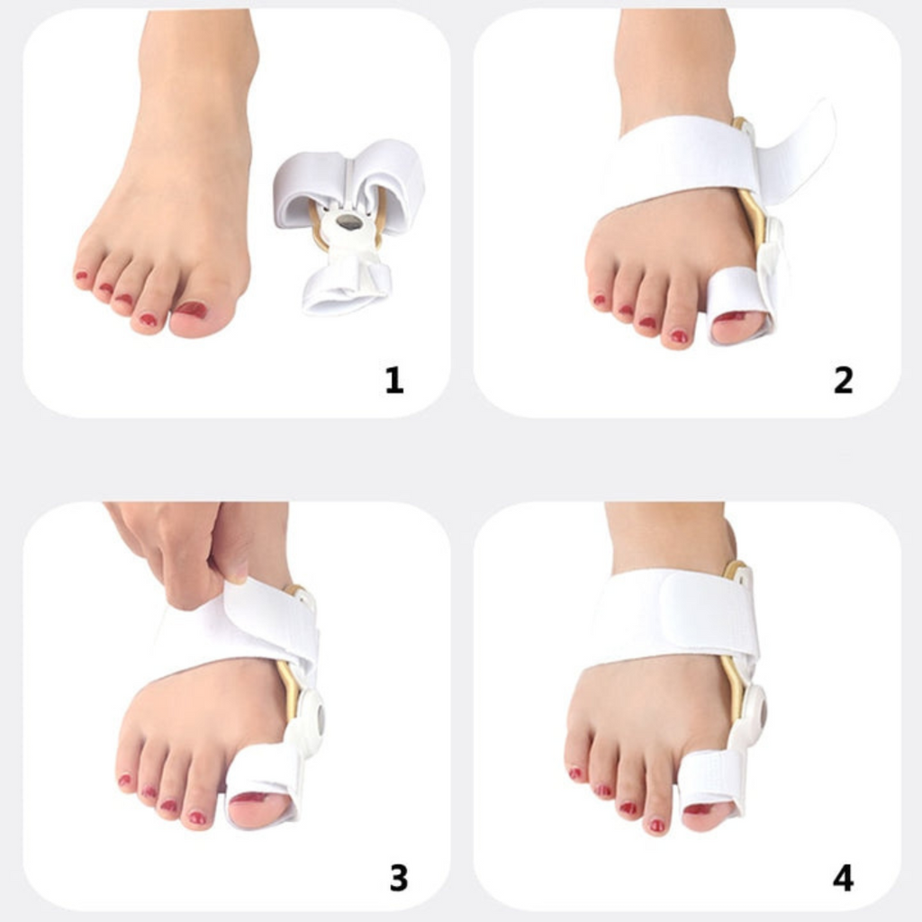 AlignaStep™ — Mettez fin à la douleur des oignons et avancez en toute confiance vers le confort