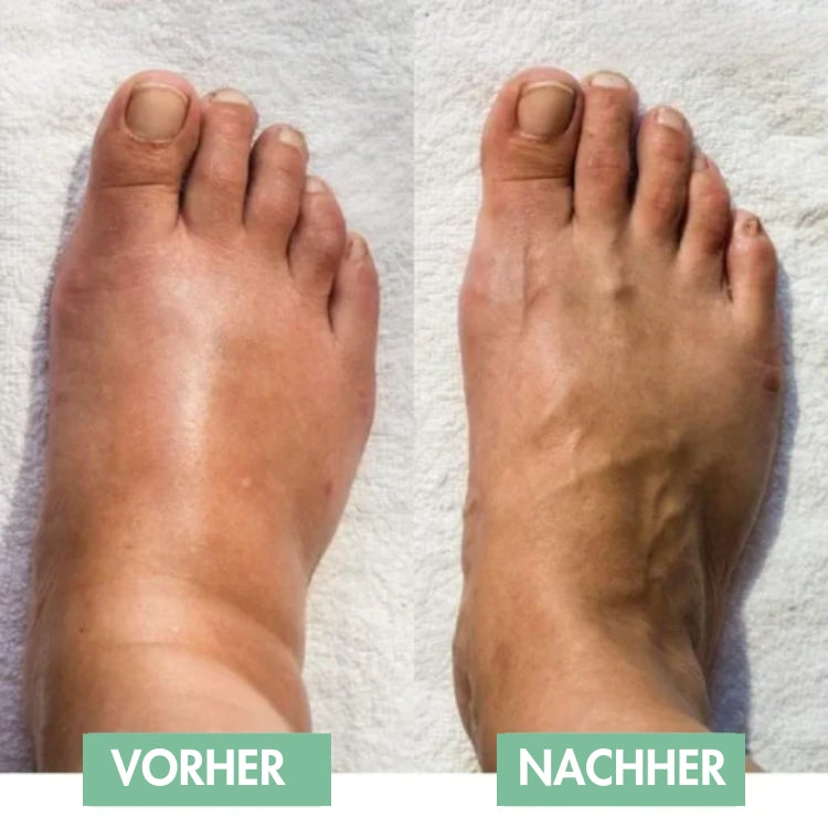 ReliefPad™ – Le massage innovant EMS pour les pieds pour un soulagement immédiat !