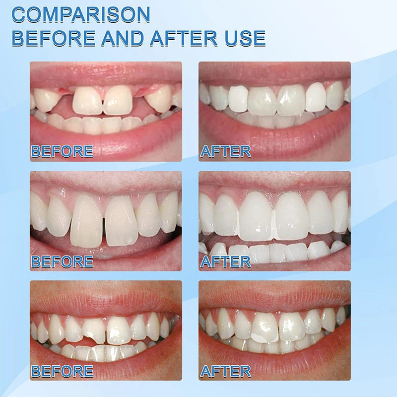 DentaForm™ — Glissez sur un sourire parfait qui se sent 100 % naturel et irrésistible