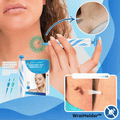 ClearSkinX™ — Éliminez les Verrues Rapidement et Libérez Votre Peau Radieuse et Éblouissante (KIT COMPLET)