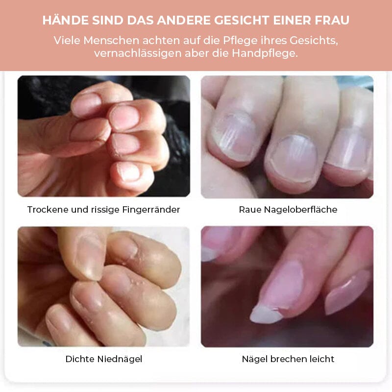 Seranail | Huile de Croissance Riche en Nutriments pour Ongles