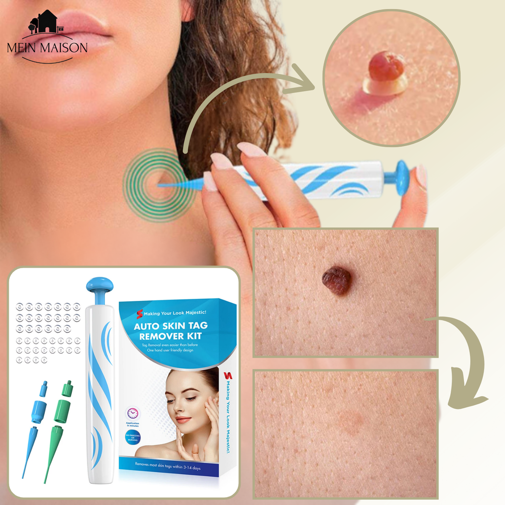 DermaLinx Éliminateur de Verrues | Élimination sans douleur des verrues et des grains de beauté | Pour la maison | Sans opération