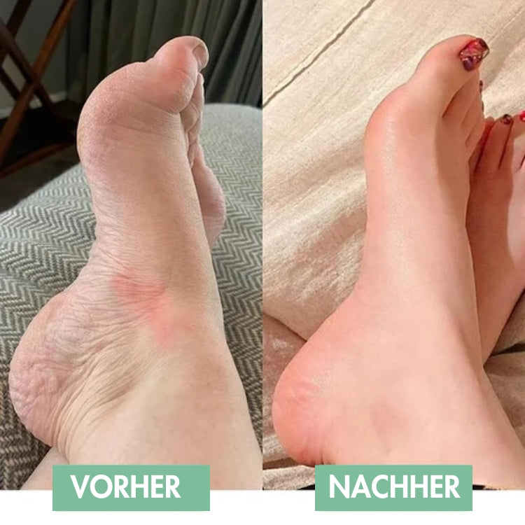 ReliefPad™ – Le massage innovant EMS pour les pieds pour un soulagement immédiat !
