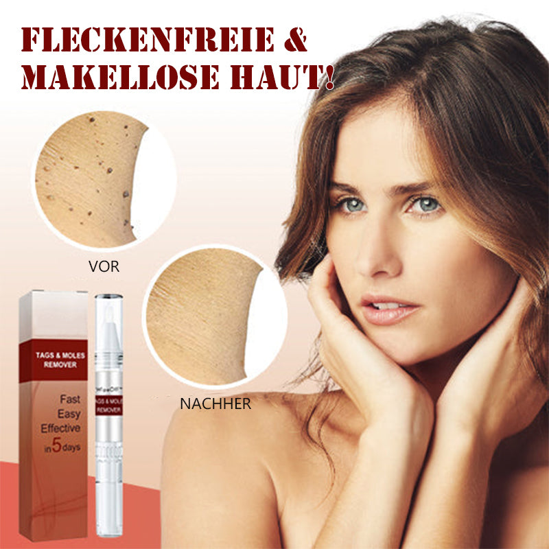 1 + 1 GRATUIT | Essence pour l'élimination des taches et des grains de beauté