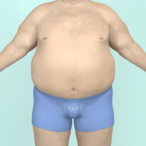 AlphaShape | Favorise la perte de tissu adipeux | Retrouve rapidement la forme !
