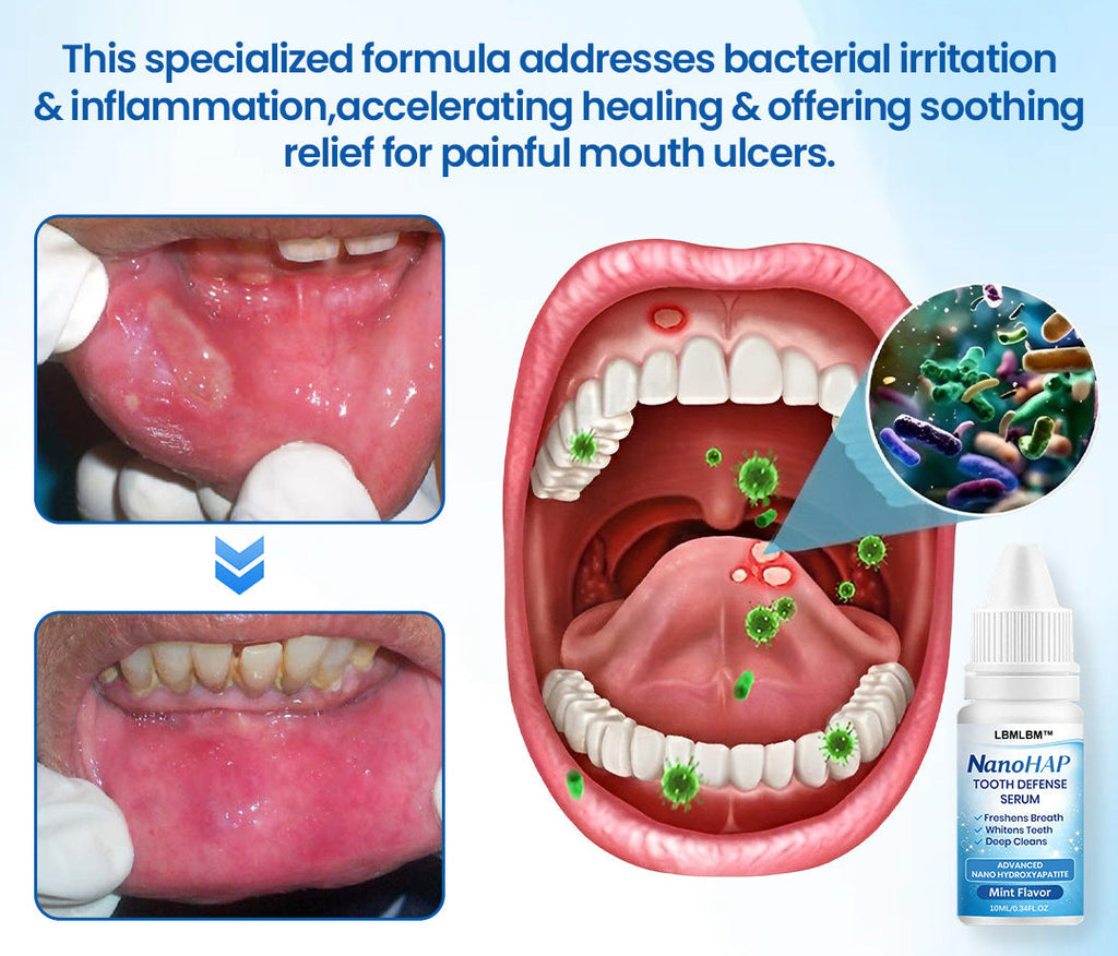 🦷 LBMLBM™ NanoHAP Sérum de Protection Dentaire