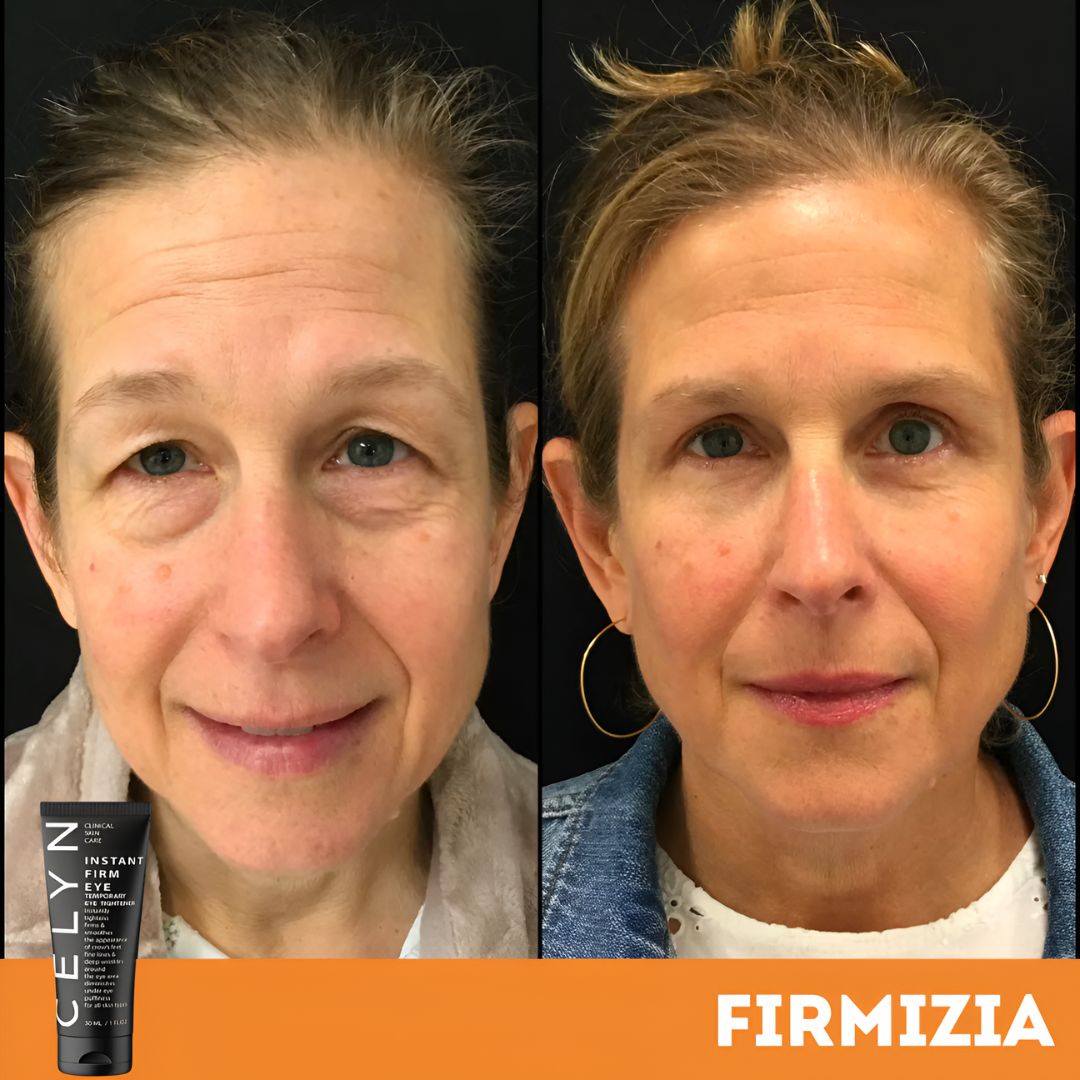 Firmizia™ - Crème anti-rides et cernes instantanée