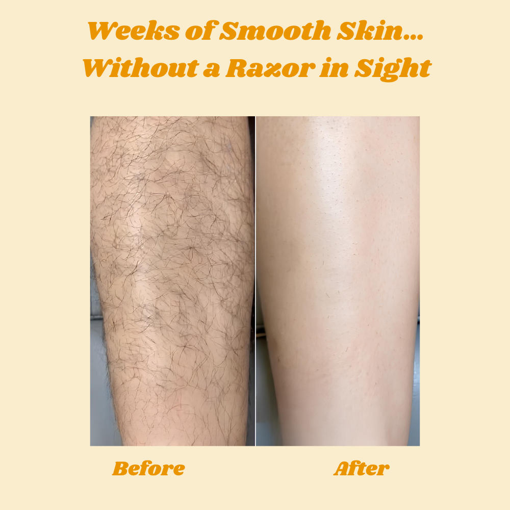 HoneyMousse™ — Découvrez une Peau Lisse et Sans Douleur qui Dure des Semaines