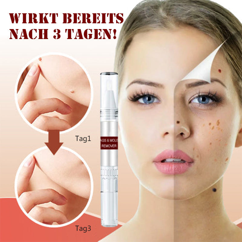 1 + 1 GRATUIT | Essence pour l'élimination des taches et des grains de beauté