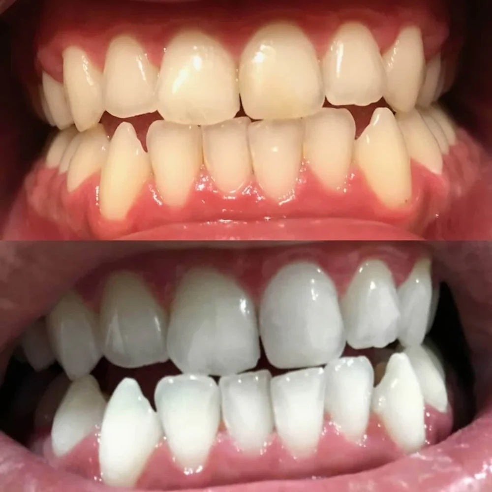 RadianceRush™ — Illuminez Chaque Pièce avec un Sourire Qui Rayonne de Confiance