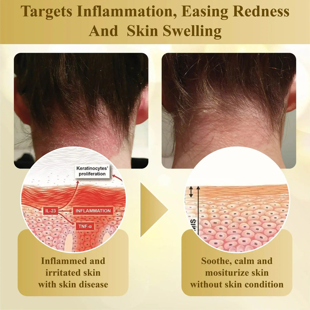 DermaLuxe™ — Faites disparaître les imperfections de la peau et brillez avec une confiance inébranlable