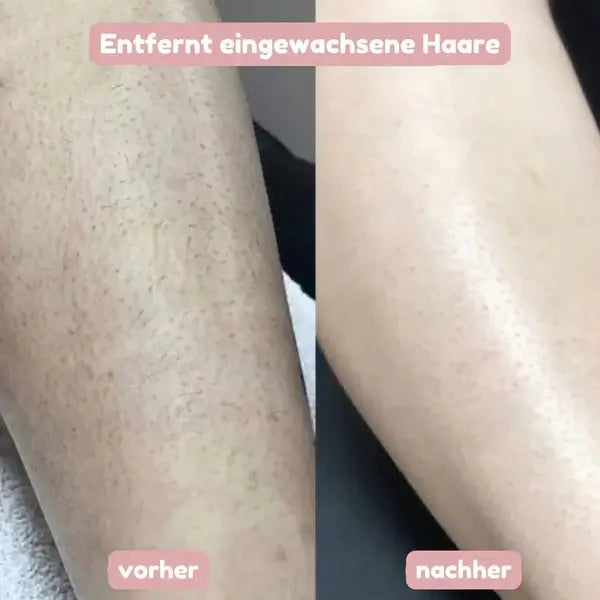 SeidenGlanz™ | Rasoir 2 en 1 pour femmes pour une peau lisse et soignée