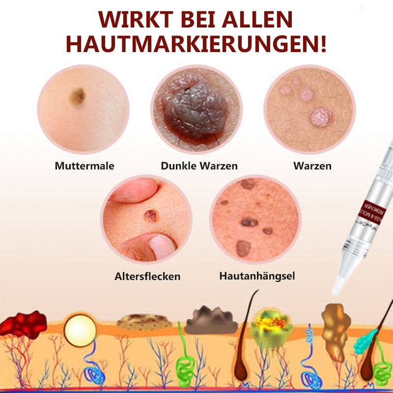 1 + 1 GRATUIT | Essence pour l'élimination des taches et des grains de beauté