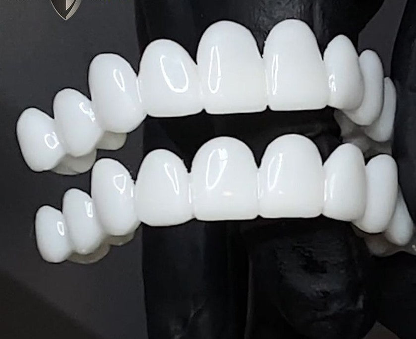 Couverture de dents Perfect Smile Snap-On