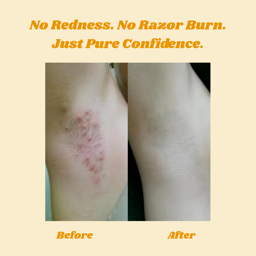 HoneyMousse™ — Découvrez une Peau Lisse et Sans Douleur qui Dure des Semaines