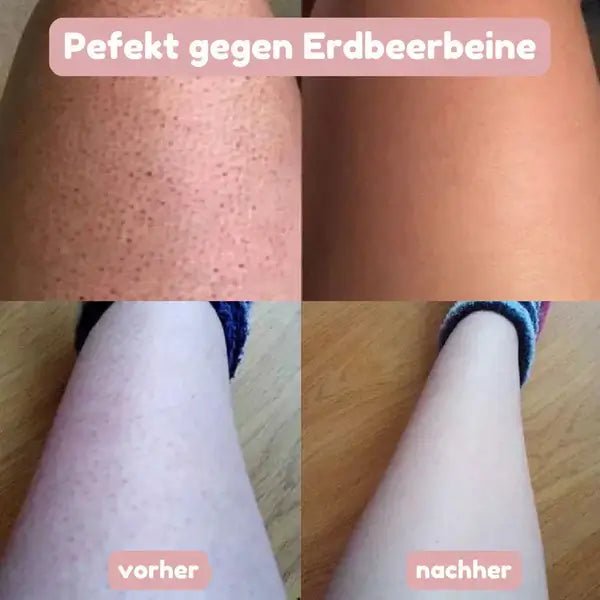 SeidenGlanz™ | Rasoir 2 en 1 pour femmes pour une peau lisse et soignée