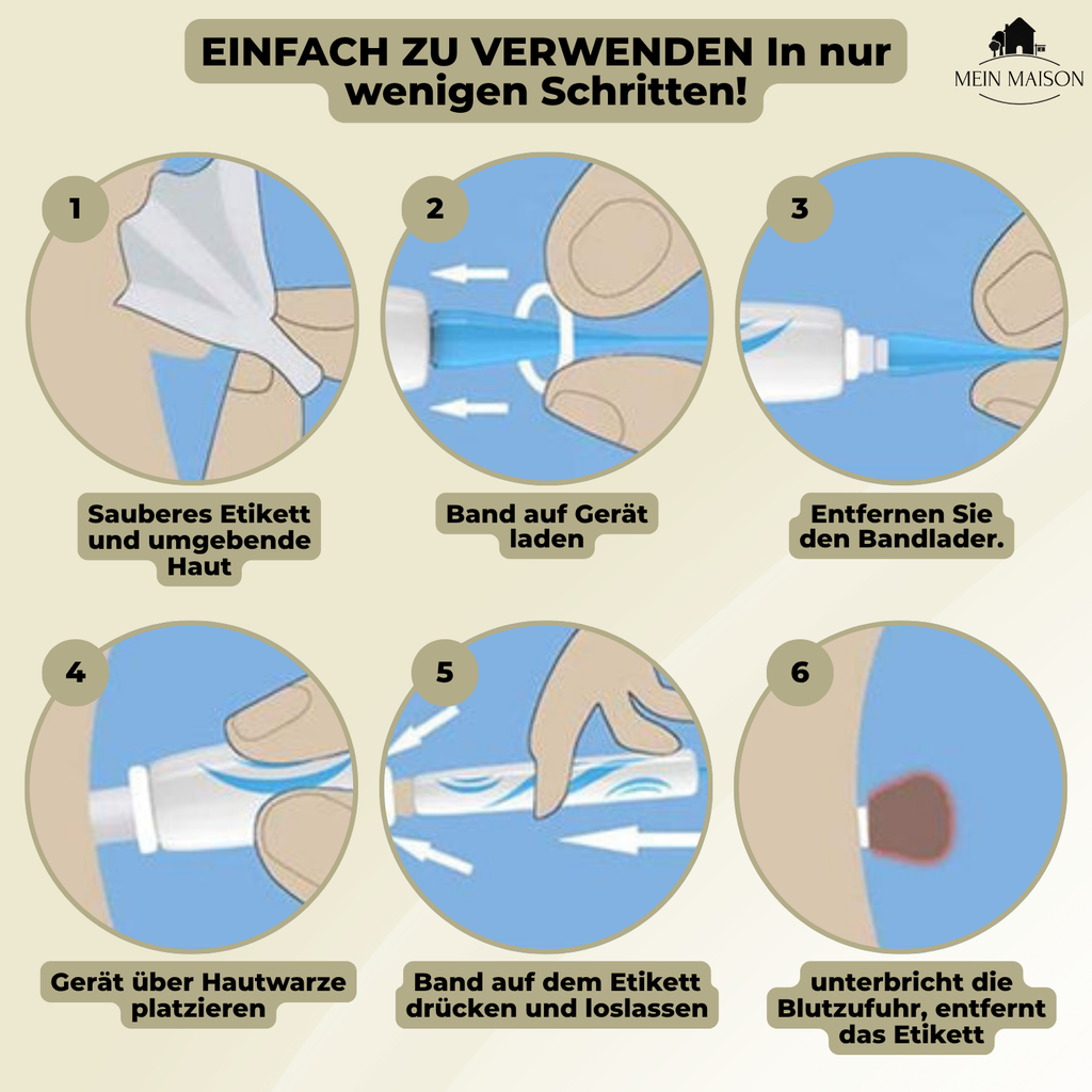 DermaLinx Éliminateur de Verrues | Élimination sans douleur des verrues et des grains de beauté | Pour la maison | Sans opération