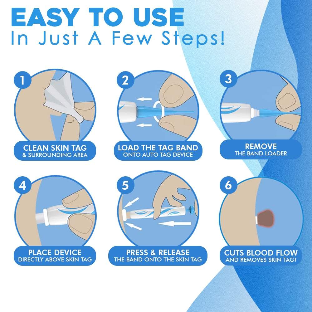 ClearSkinX™ — Éliminez les Verrues Rapidement et Libérez Votre Peau Radieuse et Éblouissante (KIT COMPLET)
