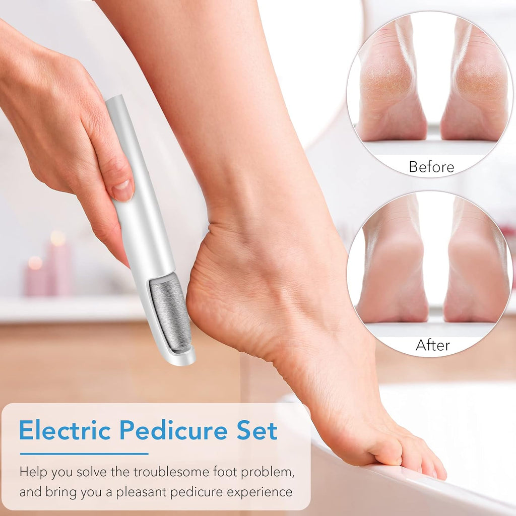 Fichier de Pied Électrique Rechargeable – Talons Lisses, À Tout Moment, Partout
