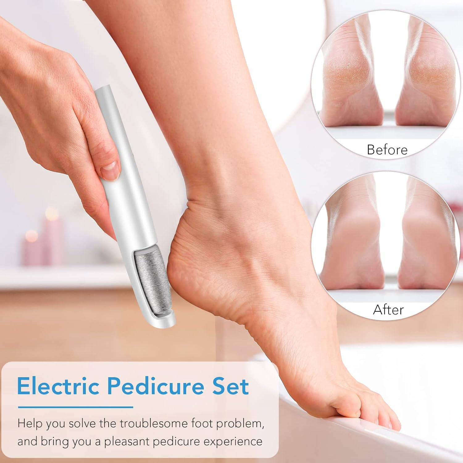 Fichier de Pied Électrique Rechargeable – Talons Lisses, À Tout Moment, Partout