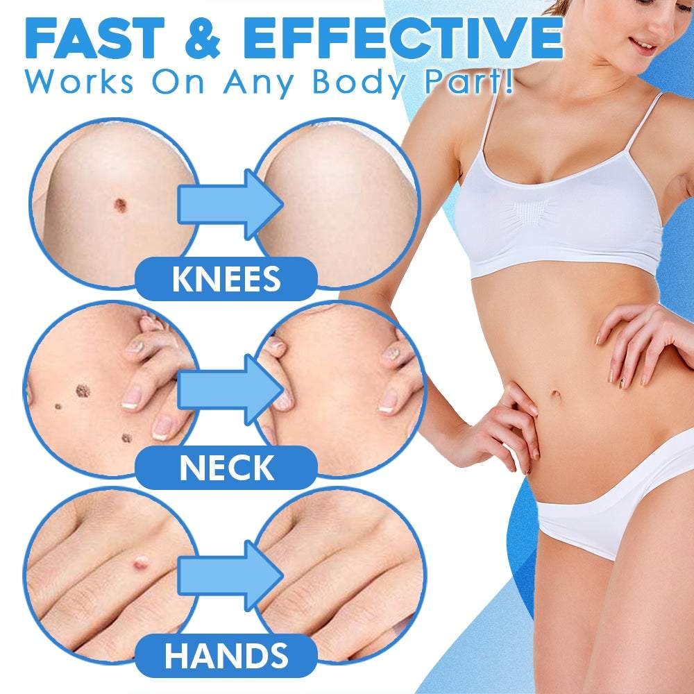 ClearSkinX™ — Éliminez les Verrues Rapidement et Libérez Votre Peau Radieuse et Éblouissante (KIT COMPLET)