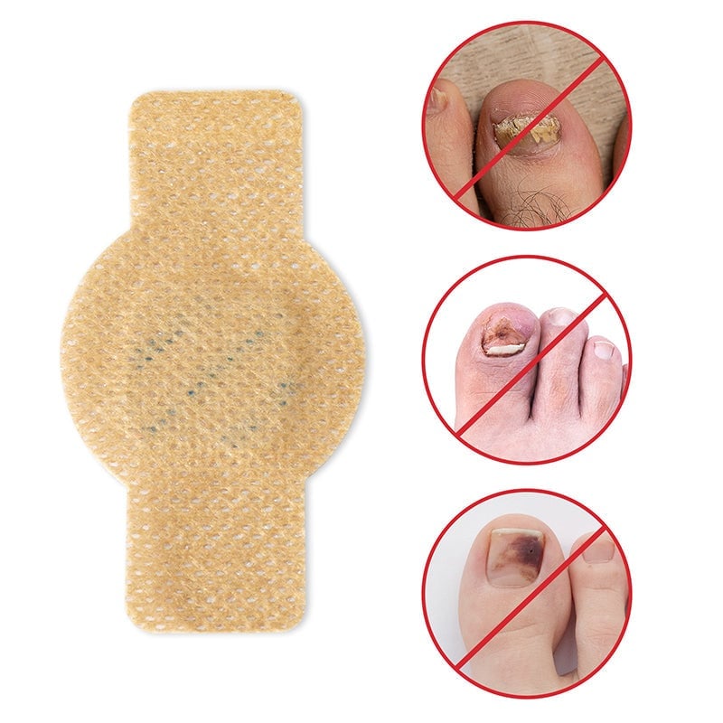 FungalPatch - Patch Antibactérien et Antifongique Pour Les Ongles