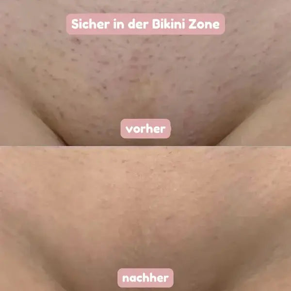 SeidenGlanz™ | Rasoir 2 en 1 pour femmes pour une peau lisse et soignée