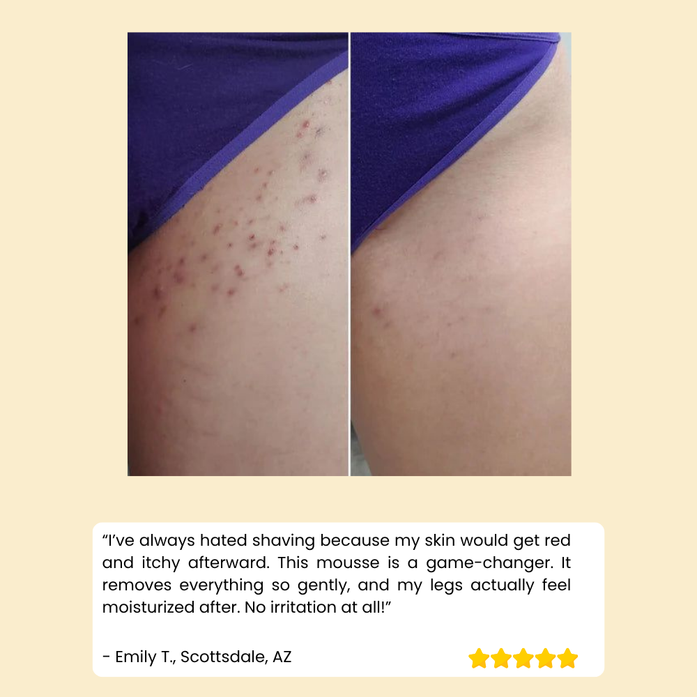 HoneyMousse™ — Découvrez une Peau Lisse et Sans Douleur qui Dure des Semaines