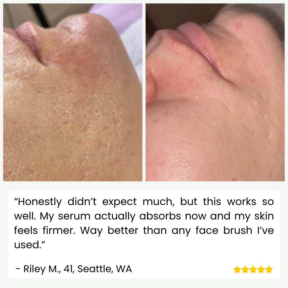 SkinPulse™ - Nettoyage Ultrasonique Professionnel de la Peau