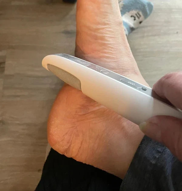 SoleSmooth - Épilateur Électrique de Callosités pour Pieds