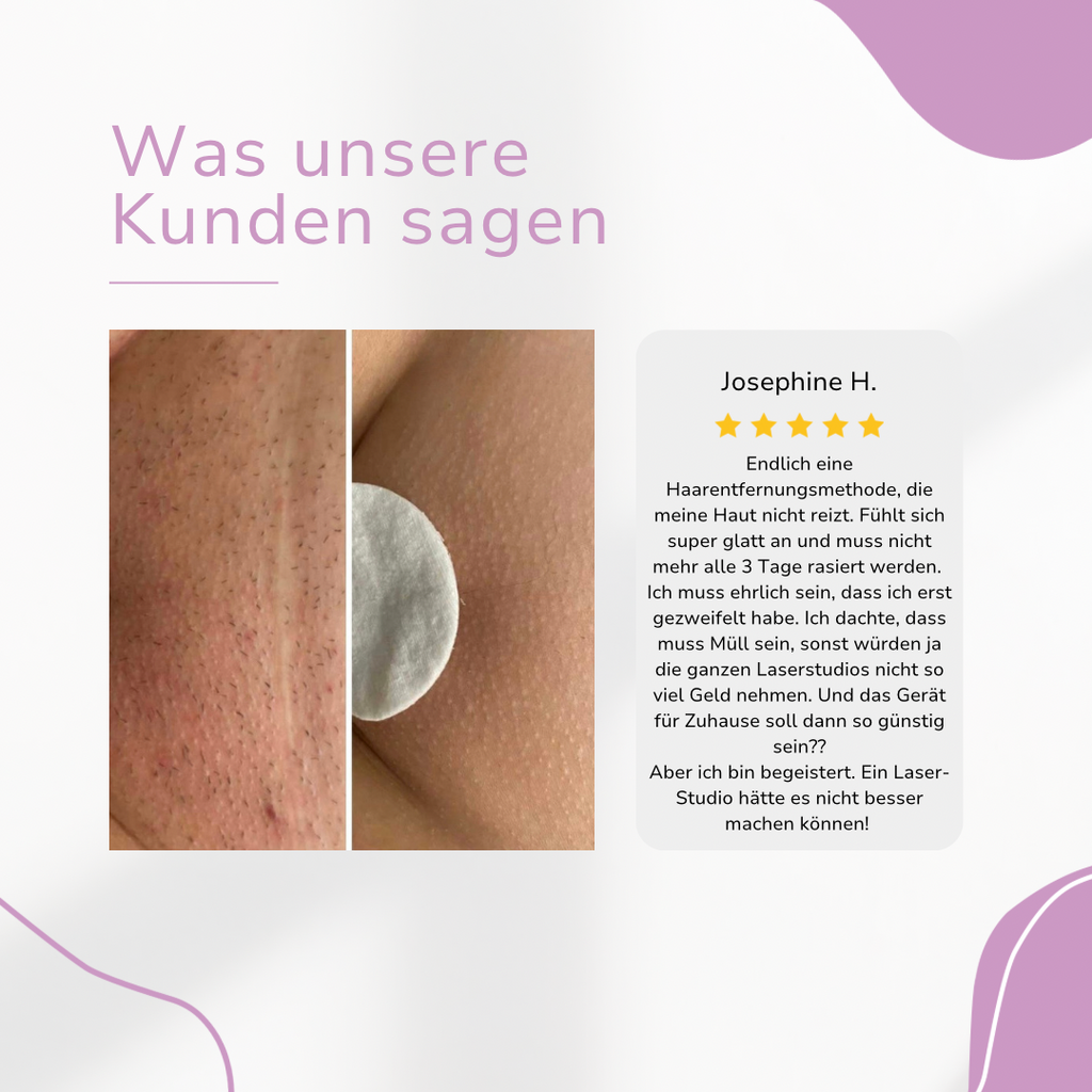 Venzani Ylvis IPL Épilateur I La meilleure épilation au laser à domicile