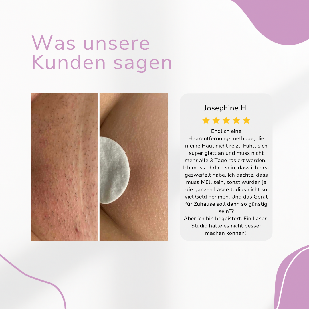 Venzani Ylvis IPL Épilateur I La meilleure épilation au laser à domicile
