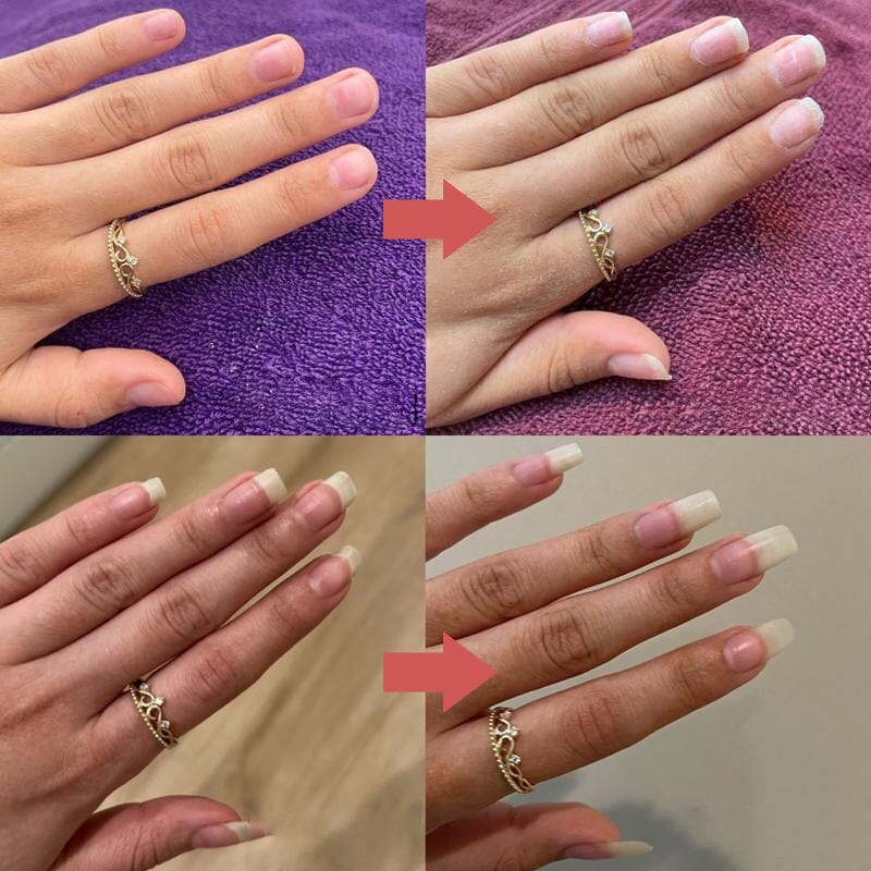 Seranail | Huile de Croissance Riche en Nutriments pour Ongles