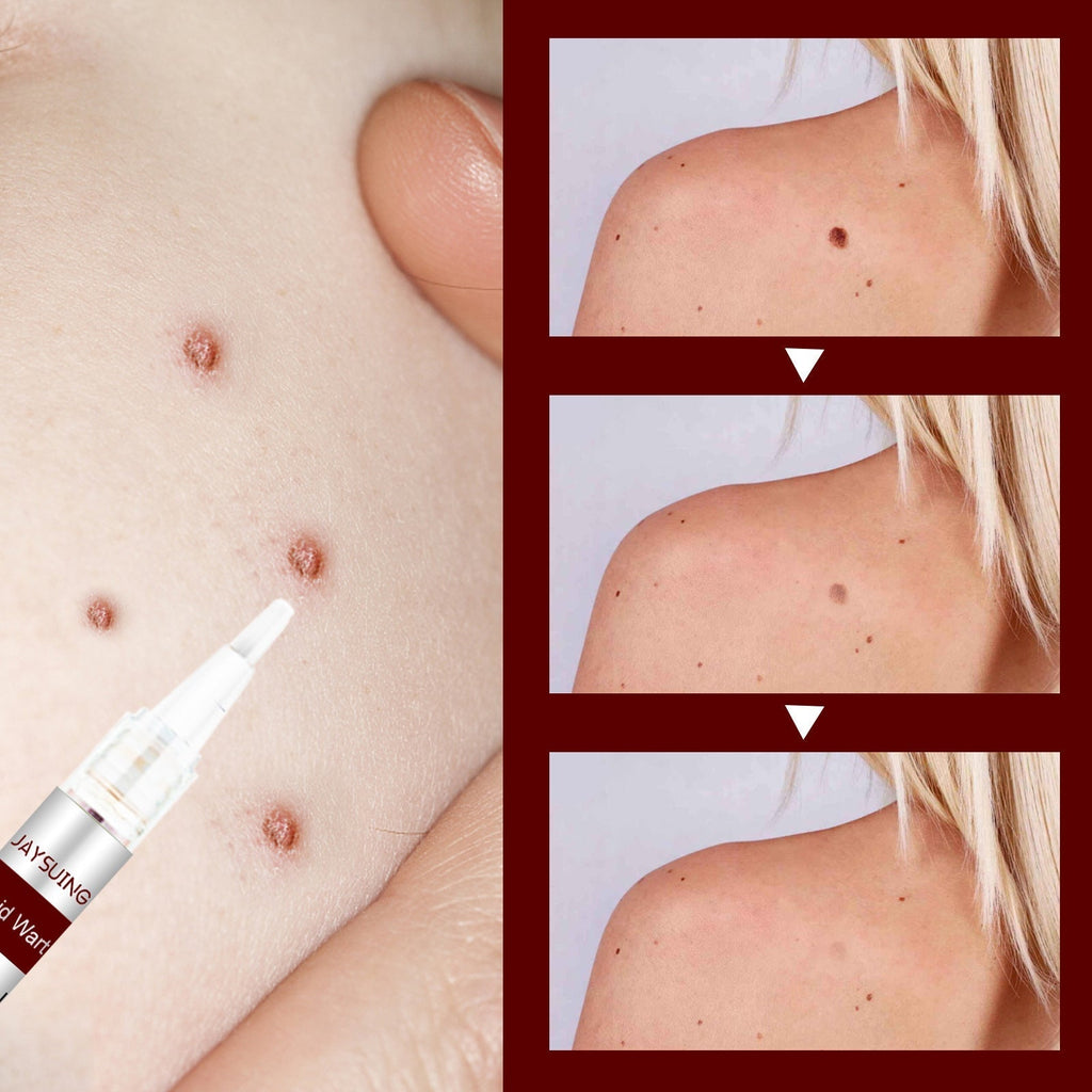 1 + 1 GRATUIT | Essence pour l'élimination des taches et des grains de beauté