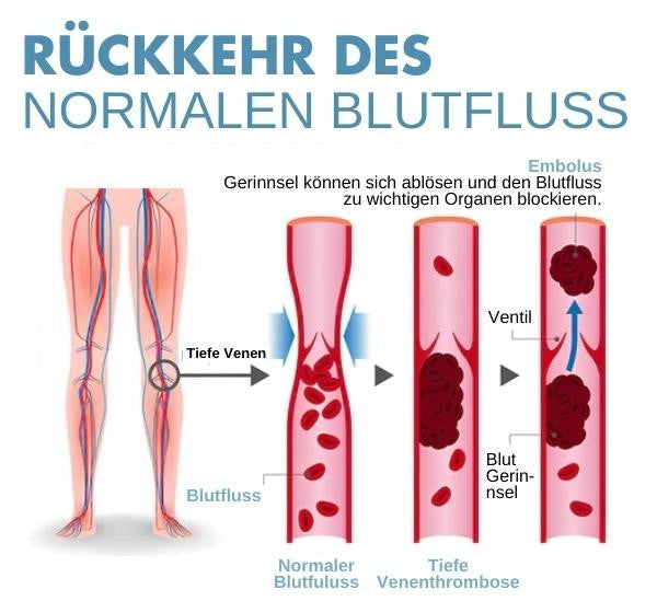 RevitaSole™ Chaussettes de Forme